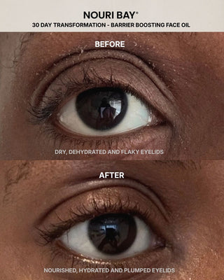 Before and after comparison of a person's eyelid condition, showing dry, dehydrated, and flaky eyelids on the top panel and nourished, hydrated, and plumped eyelids on the bottom panel. Text at the top reads 'NOURI BAY 30 DAY TRANSFORMATION - BARRIER BOOSTING FACE OIL', sensitive skin.